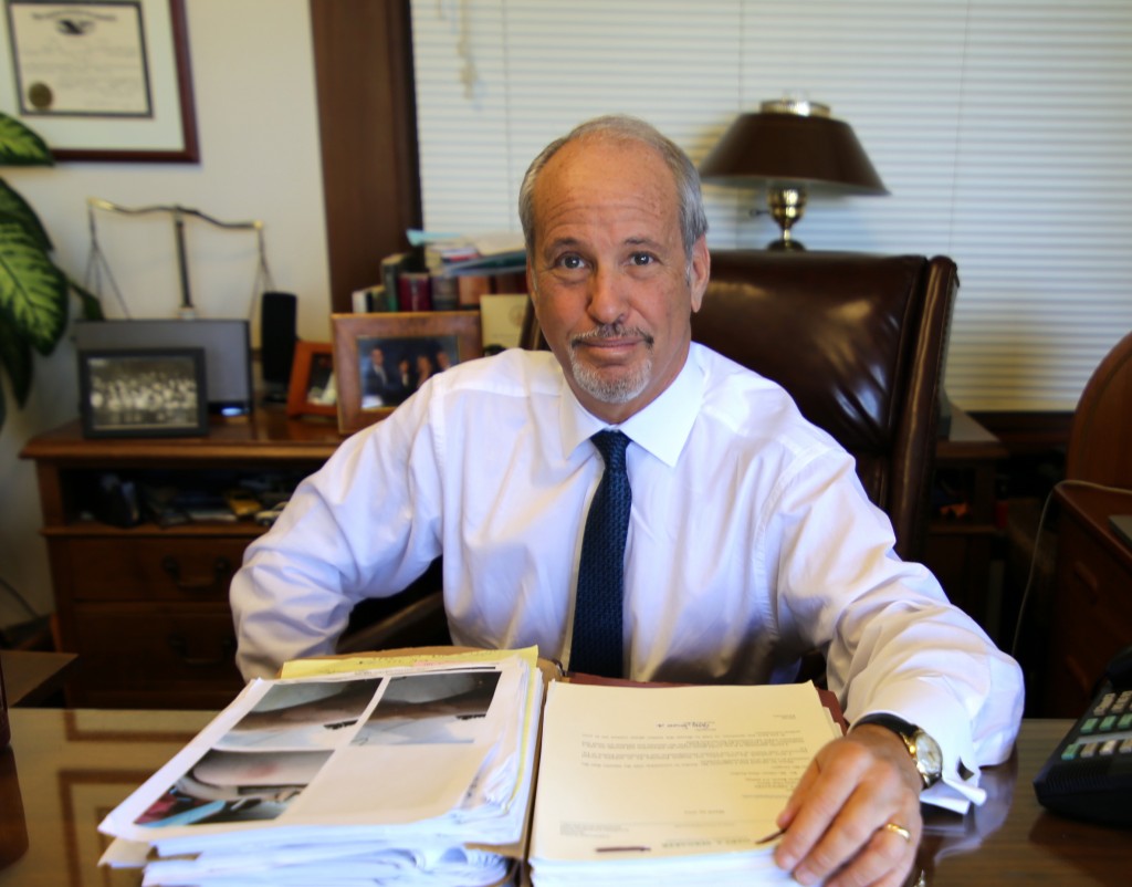 San Diego Amputation Lawyer