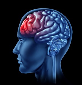 Brain Injuries and your Rights